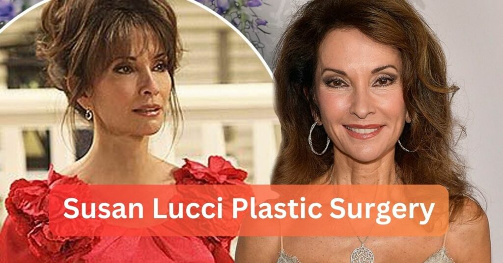 Susan Lucci Plastic Surgery
